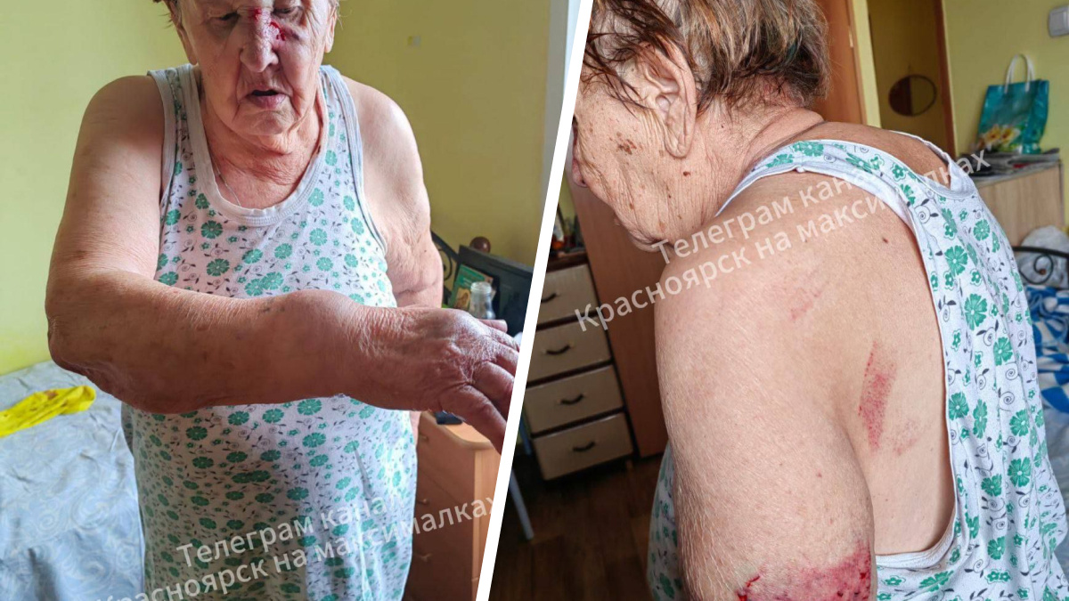 Постояльцы избили 89-летнюю красноярку в пансионате «Ветеран» из-за трансляции с Пасхи