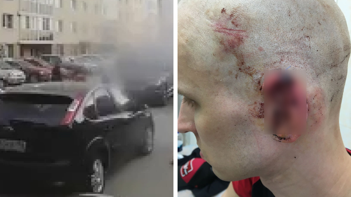 «На мне 17 швов»: в Екатеринбурге мужчина с камнями в руках неожиданно накинулся на велосипедиста