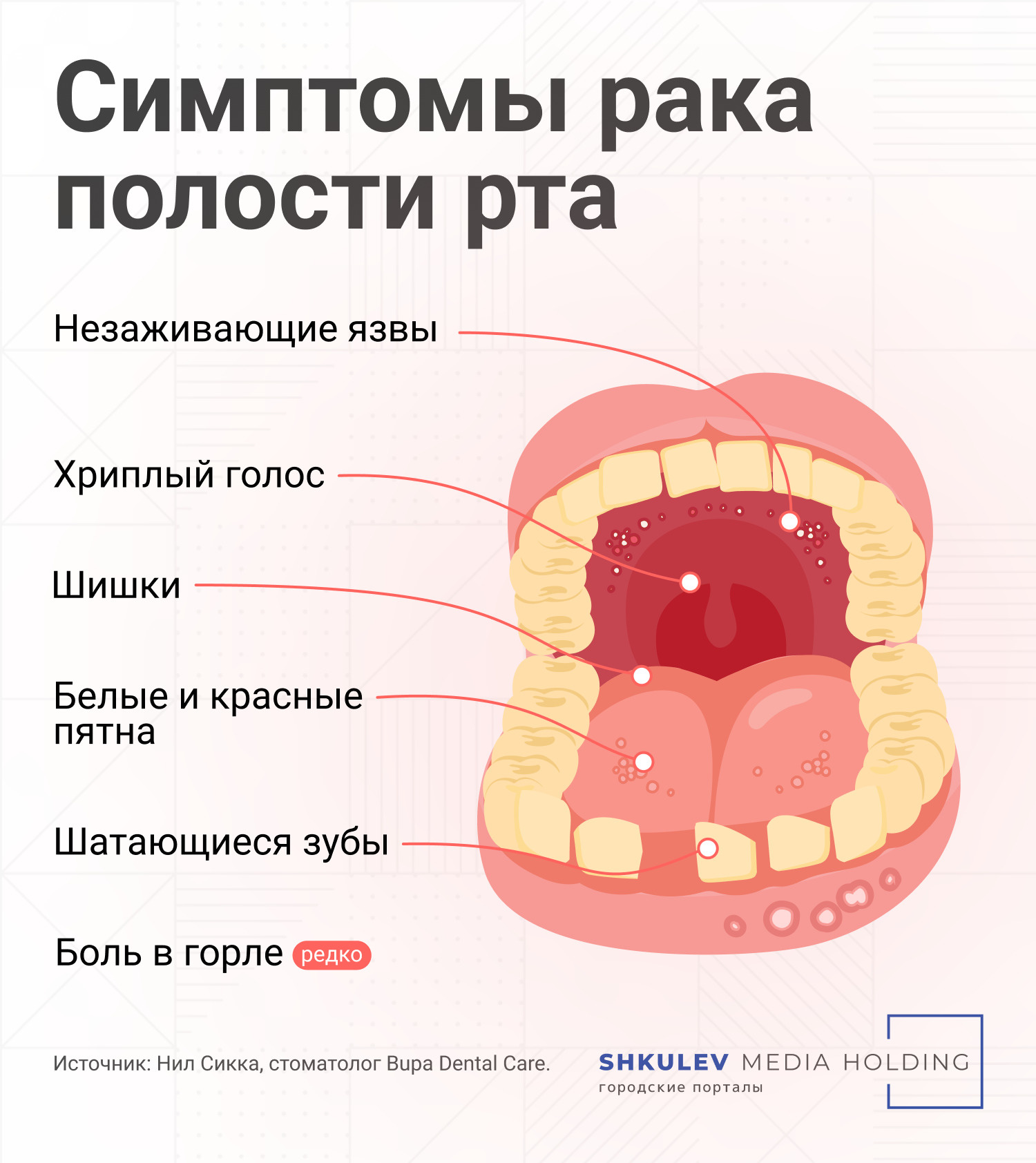 Основные признаки рака полости рта, на которые следует обратить внимание