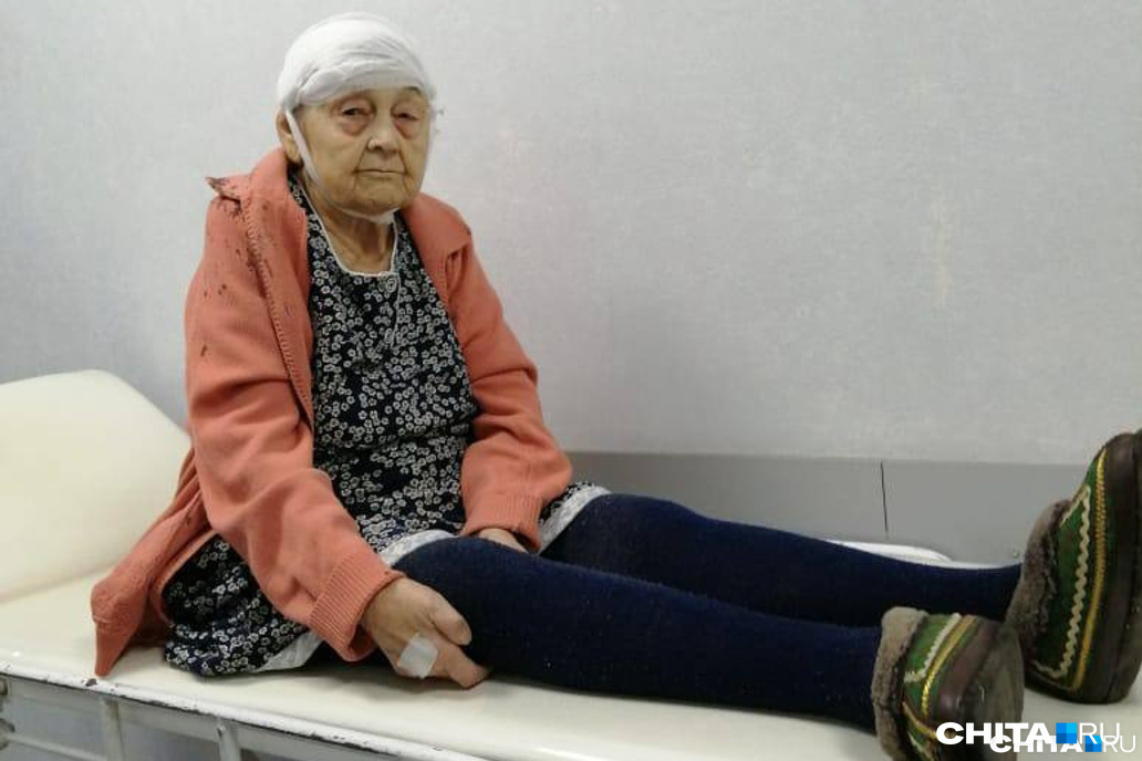 Минздрав Забайкалья не смог объяснить, почему травмированную пенсионерку 11 часов возили между больницами в Чите