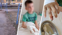 Бастрыкин заинтересовался тяжелой травмой ребенка на детской площадке в Челябинске