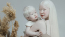 Единственные в Казахстане сестры-альбиносы покоряют мир своей нетипичной красотой — посмотрите на них