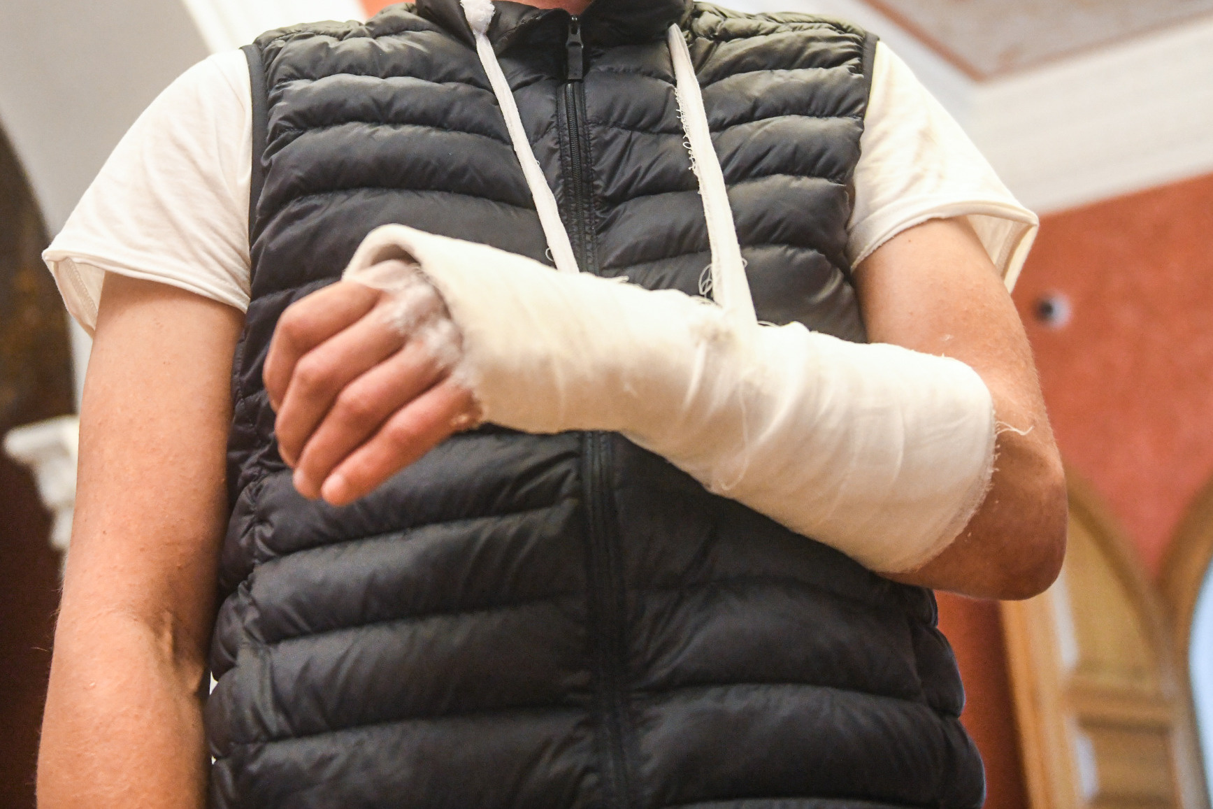 Жителя Краснокаменска ударил человека ломом и сломал ему руку