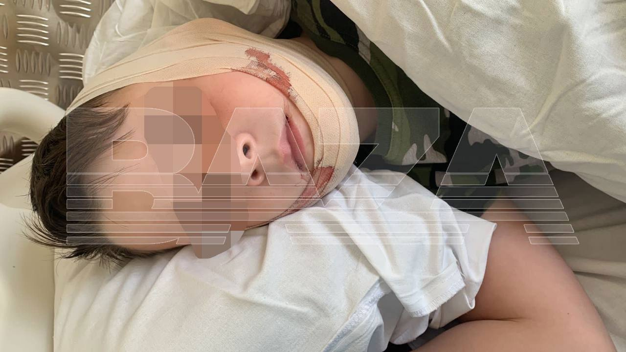 Новосибирский полицейский на электросамокате сбил 8-летнего мальчика — у ребенка сломана челюсть