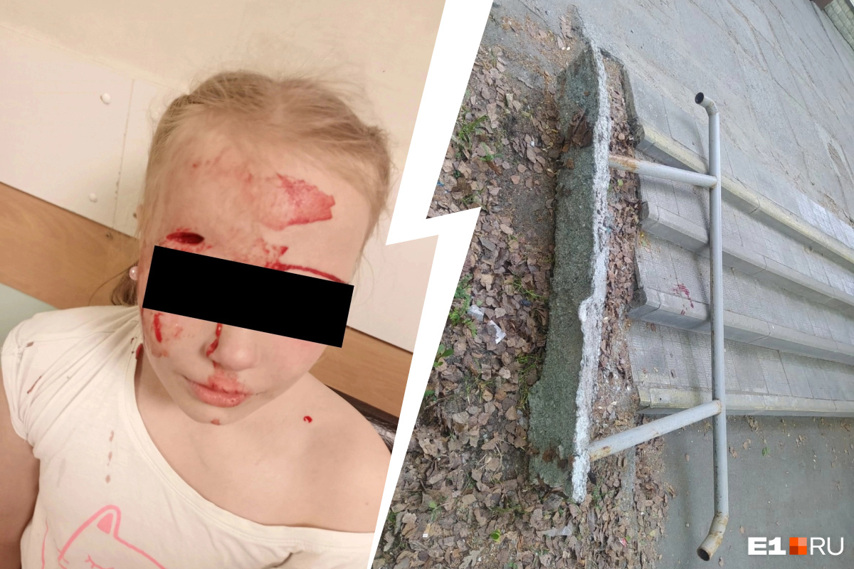 На Урале маленькая девочка разбила голову во время прогулки. Всё из-за шатких перил